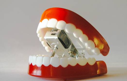 Zębowe licówki